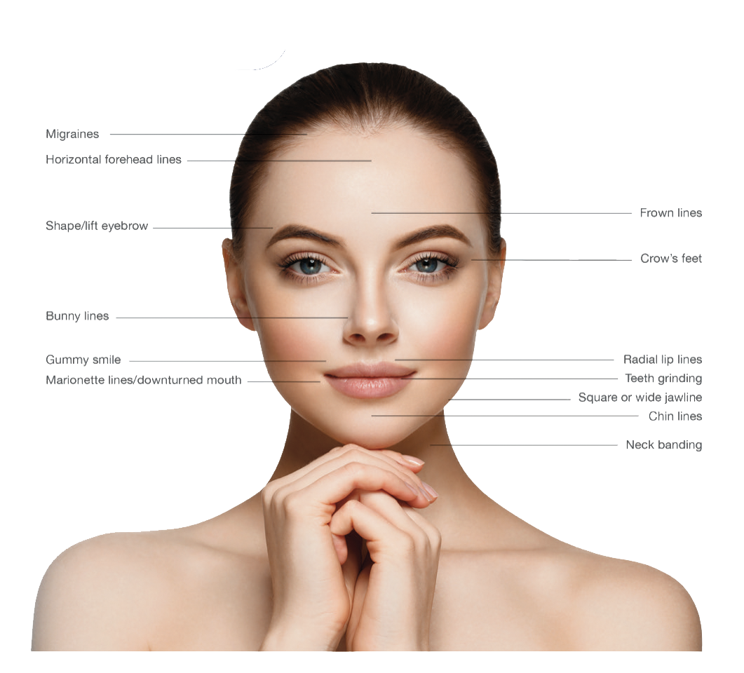 Botox areas